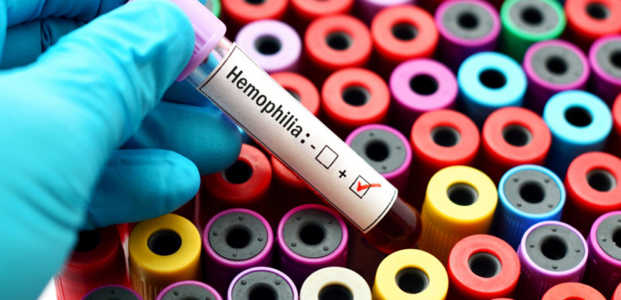 Encuesta de la situación actual latinoamericana de Hemofilia y otras alteraciones de la coagulación.